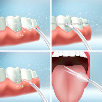 Rechargeable Oral Irrigator